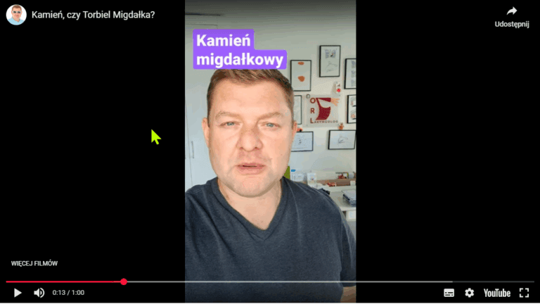 Mam coś na migdałku, co to może być?